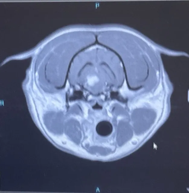 A cross-section image from Rocco&rsquo;s brain MRI, photographed from the screen on the day of his scan